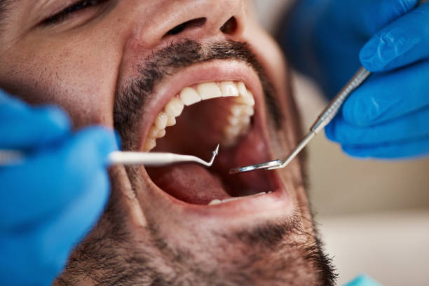 Best Emergency Treatment for Dental Infections or Abscesses in Fort Smith, AR